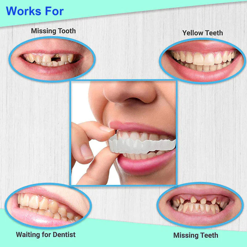 Snap On Braces